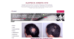 Desktop Screenshot of alopeciaareatanyc.net